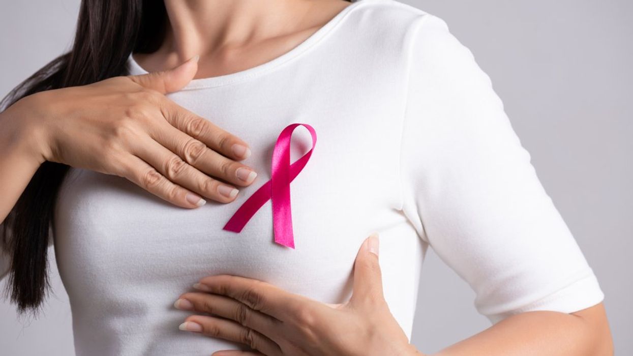 Breast Cancer Screening Should Be Done at a Younger Age