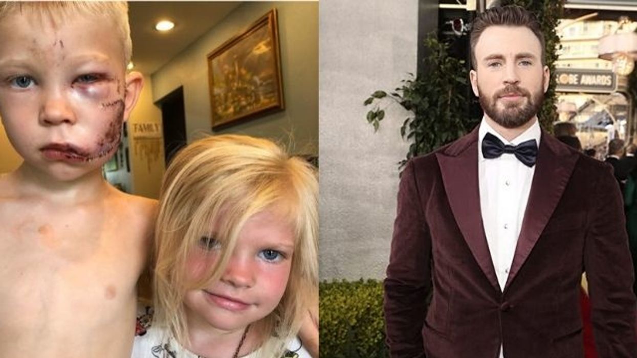 Chris Evans Praises 6-Year Old Boy Who Saved Sister From Dog Attack