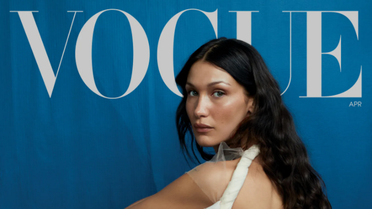 Bella Hadid Gets Candid About Plastic Surgery and Mental Health