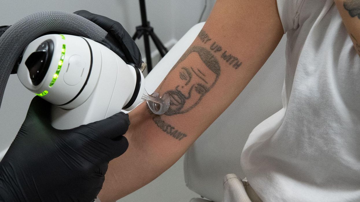 Tattoo Removal Studio Is Removing Kanye West Tattoos for Free